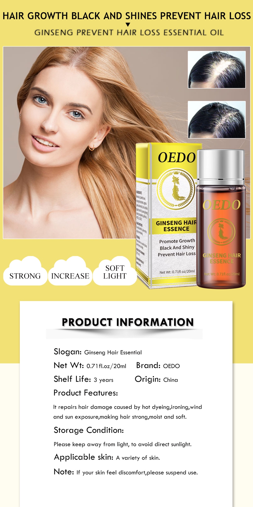 OEDO Ginseng Hair Growth Essence Preventing Hair Loss Liquid Damage Hair  Repair Treatment Fast Restoration Hair Growth | Shopee Singapore