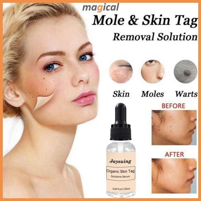 organic skin tag solution serum