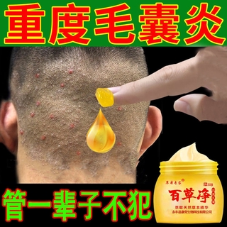 Scalp and Back Folliculitis Refractory Rash Chest Acne Sterilization Hair Follicle Blocking Skin Itching Relieving Antibacterial Cream