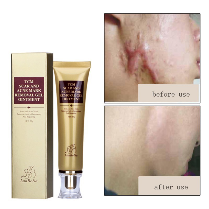 good face cream for spots