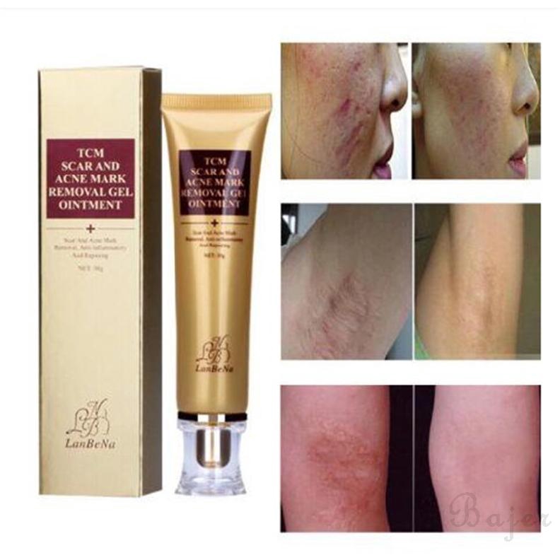acne scar removal moisturizer