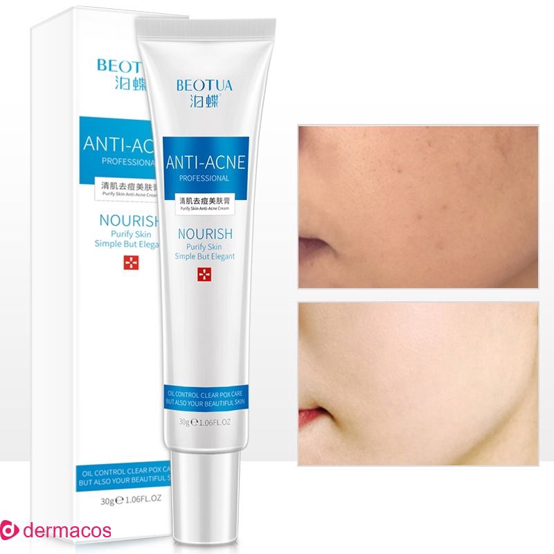 acne cream moisturizer