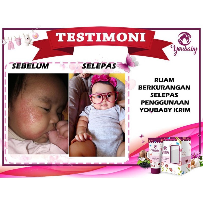 Youbaby Cream Multi Function Cream Anti Cough Yellow Kurap Kudis Head Eczima Yellow Features Jourse Heads Eczima Shopee Singapore