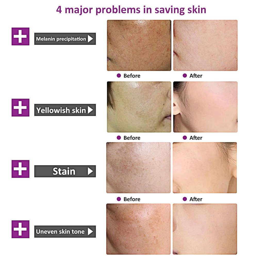 scobuty whitening cream price