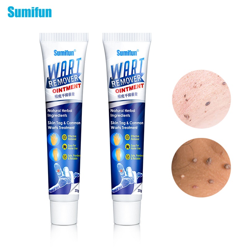 Wart Removal Cream Body Warts Removal Cream Foot Care Cream Foot Warts Removal Plantar Warts Ointment Shopee Singapore