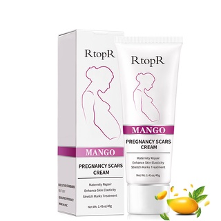 RtopR Mango Remove Pregnancy Scars Acne Cream Stretch Marks Treatment Maternity Repair Anti-Aging Anti-Winkles Firming Body Creams #6