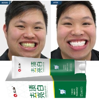 Kem Đánh Trắng Răng Ố Vàng, Kem Đánh Trắng Răng Thơm Miệng, Kem Đánh Răng Ngừa Sâu Răng