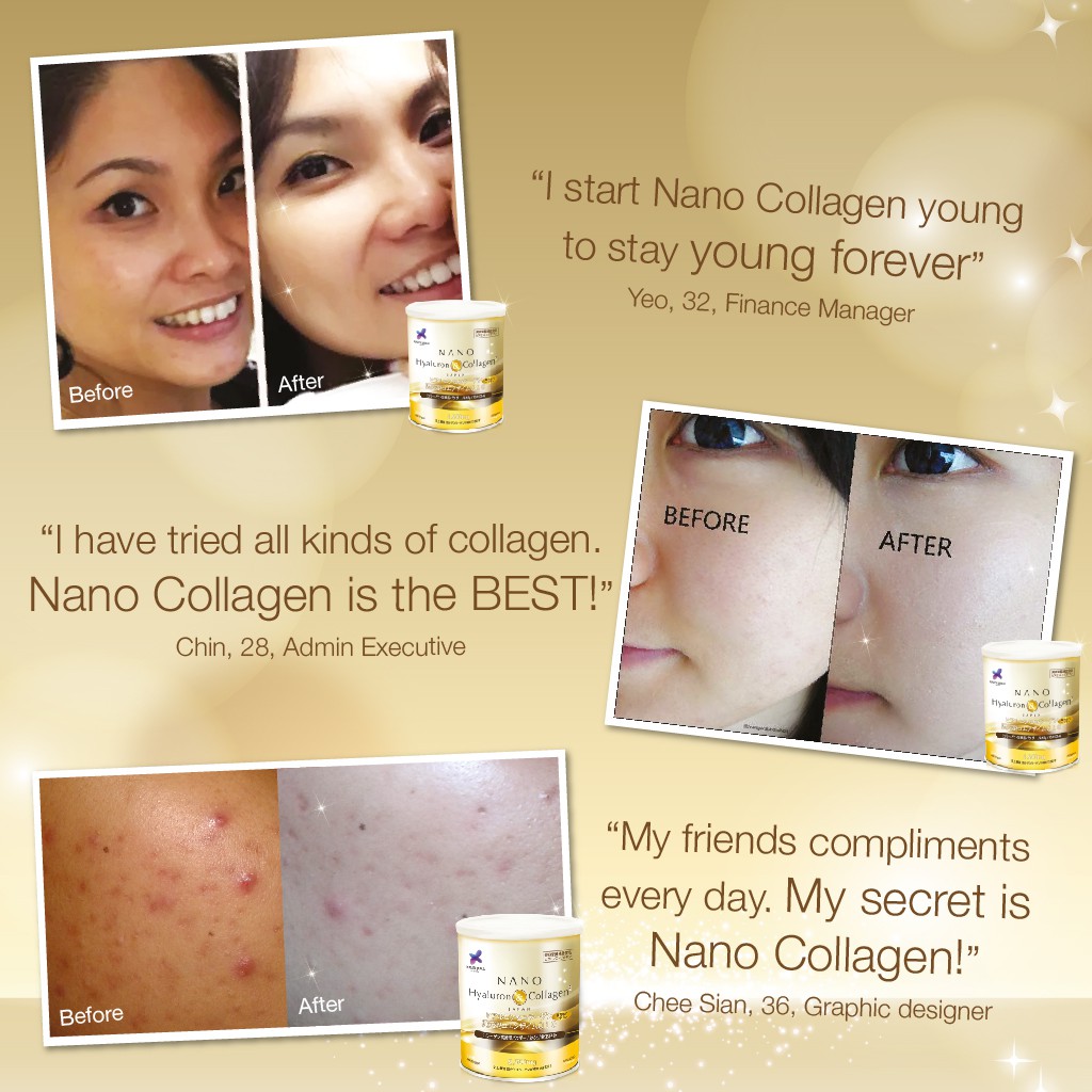 Nano Hyaluron Collagen Skin Whitening Bustline Lifting 36 Servings Shopee Singapore