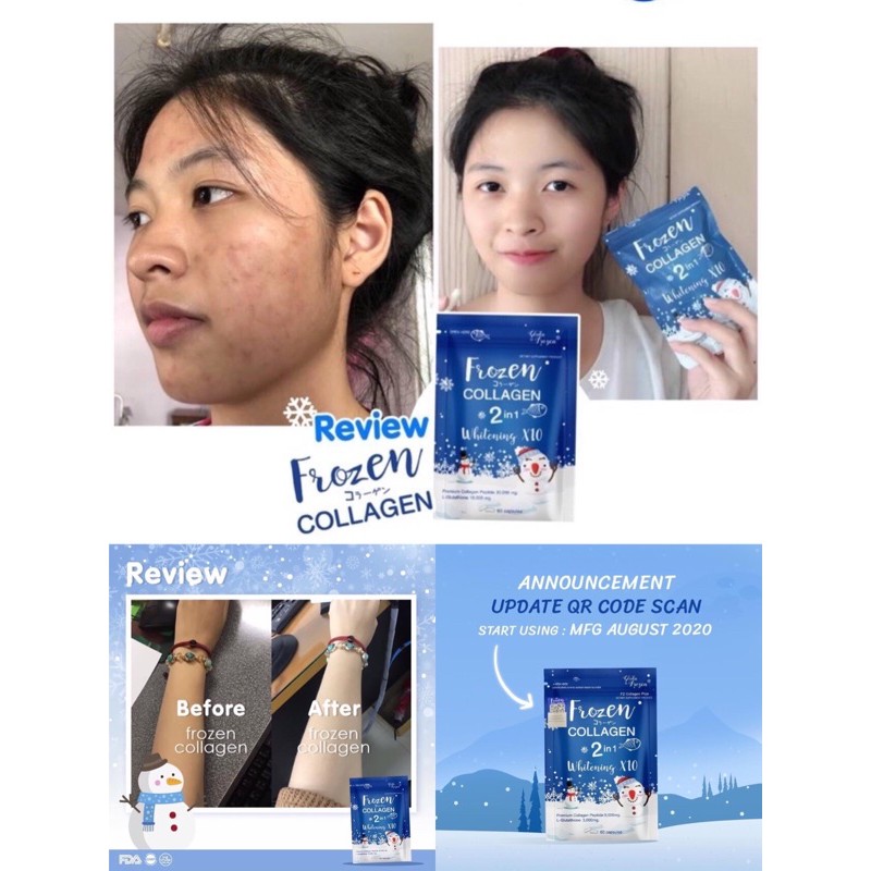 Frozen Collagen 100 Original Qr Code Whitening Repair Skin 60capsules Singapore