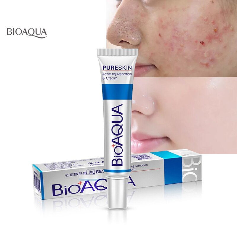 cream bioaqua acne