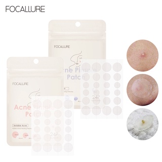 FOCALLURE Waterproof Acne Patch Blemish Treatment Skin Care Acne Repair  oxy acne pimple   Clear Fit Master Patch Acne