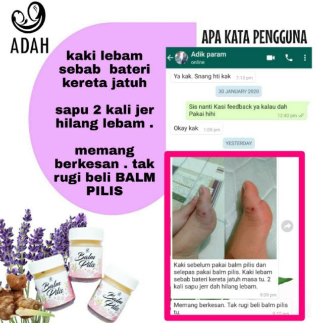 30g Balm Pilis Balm Param For Mother Installing Ori Hq 100 Shopee Singapore