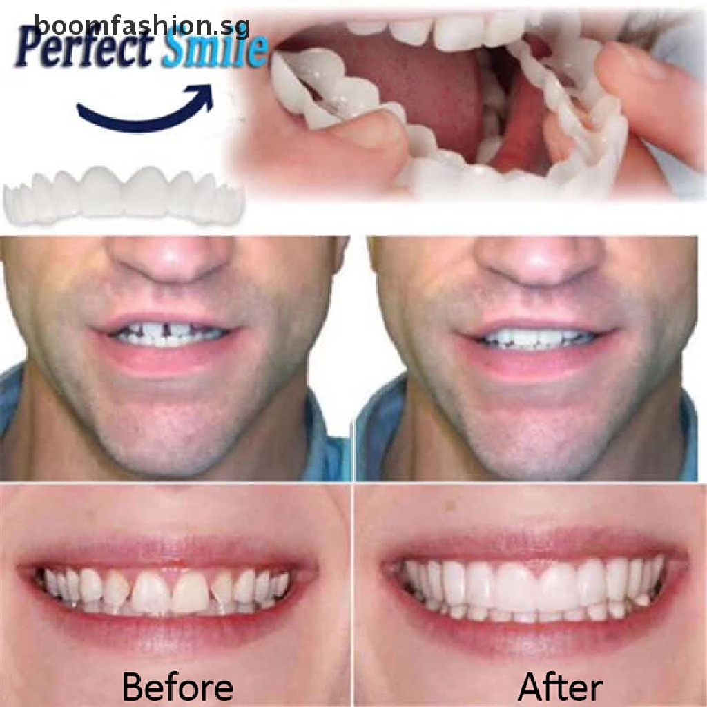 Image of [boomfashion] 3X Cosmetic ry Instant Perfect Smile Comfort Fit Flex Teeth Veneer [SG] #7