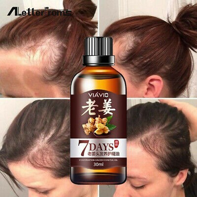 MALAYSIA FAST SHIPPING Hair Growth Essence 7 Days Ginger ...