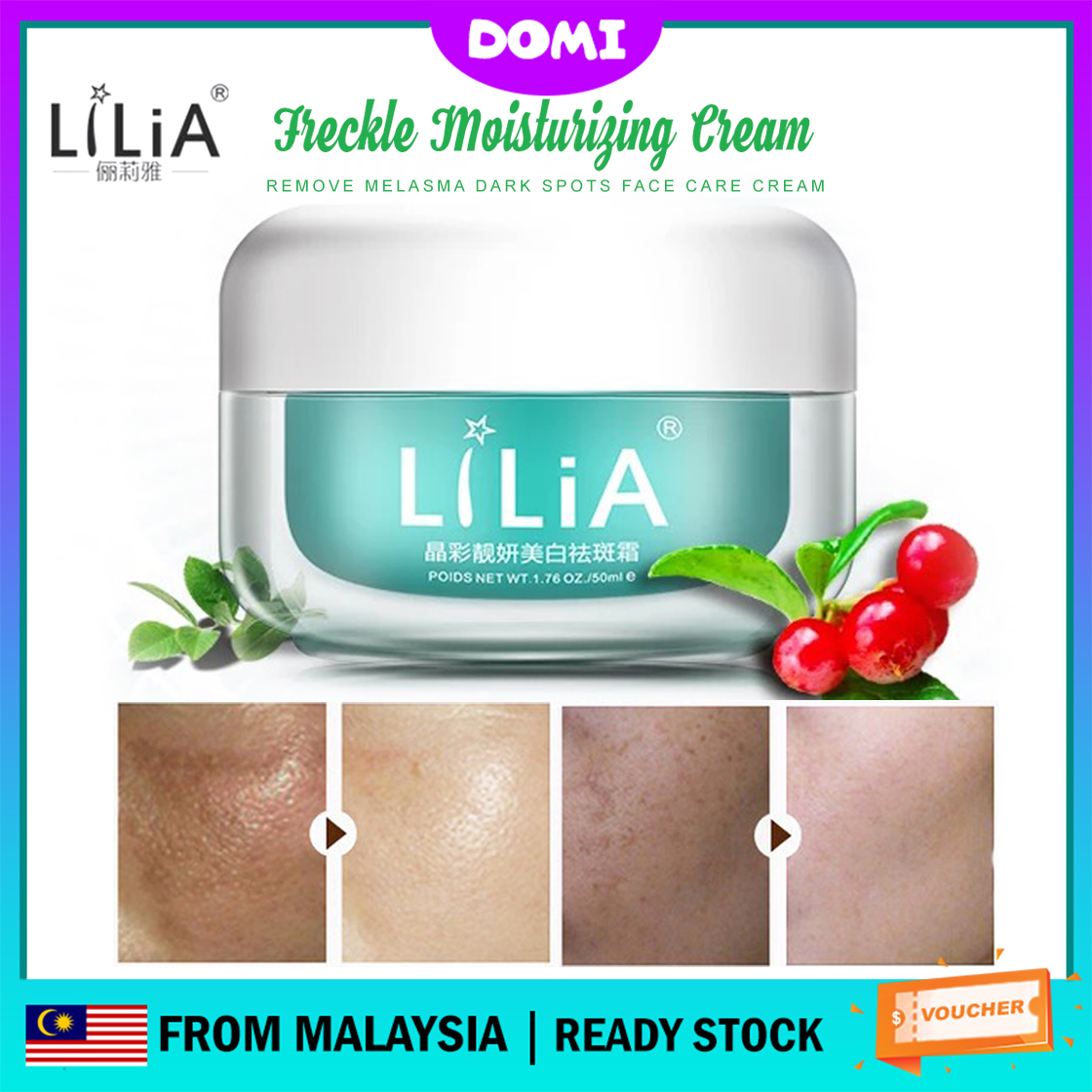 melasma clear
