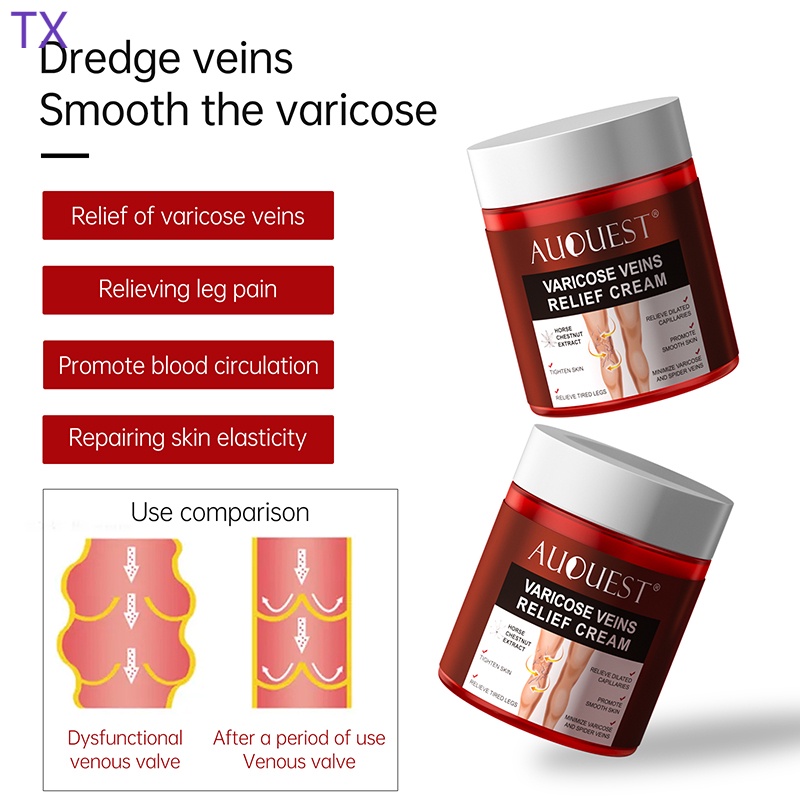 Varicose Veins Relief Cream Original Vasculitis Phlebitis Spider Pain