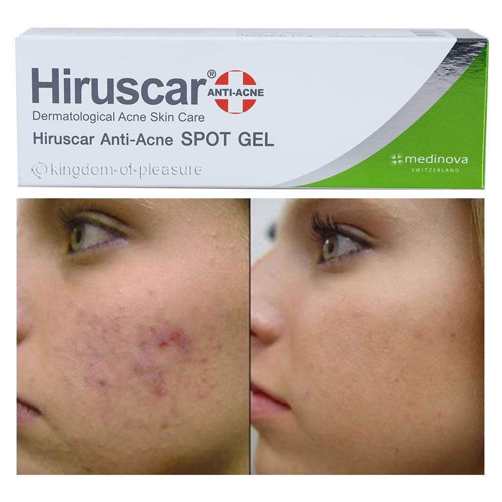 Hiruscar Anti Acne Spot Gel 10g Shopee Singapore