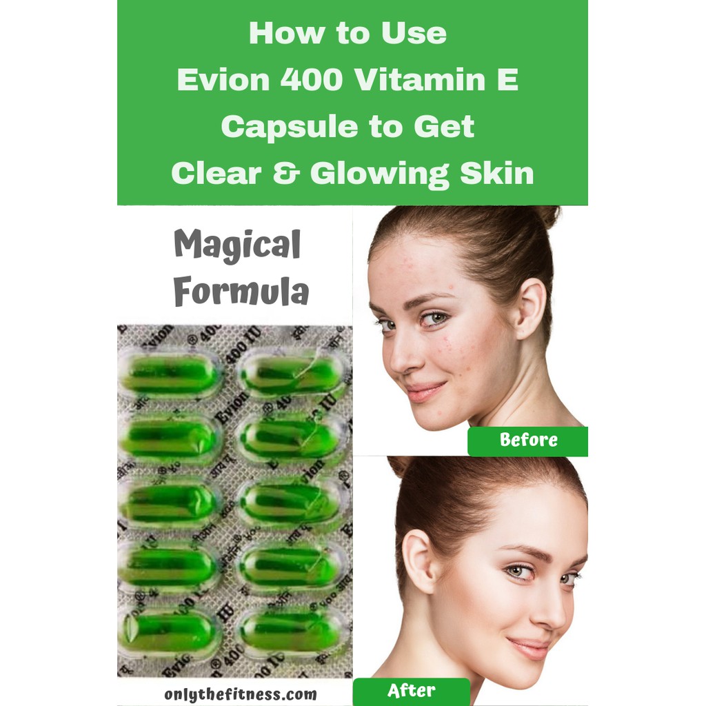 Evion vitamin-E capsule usp 400mg (20 capsules) | Shopee Singapore