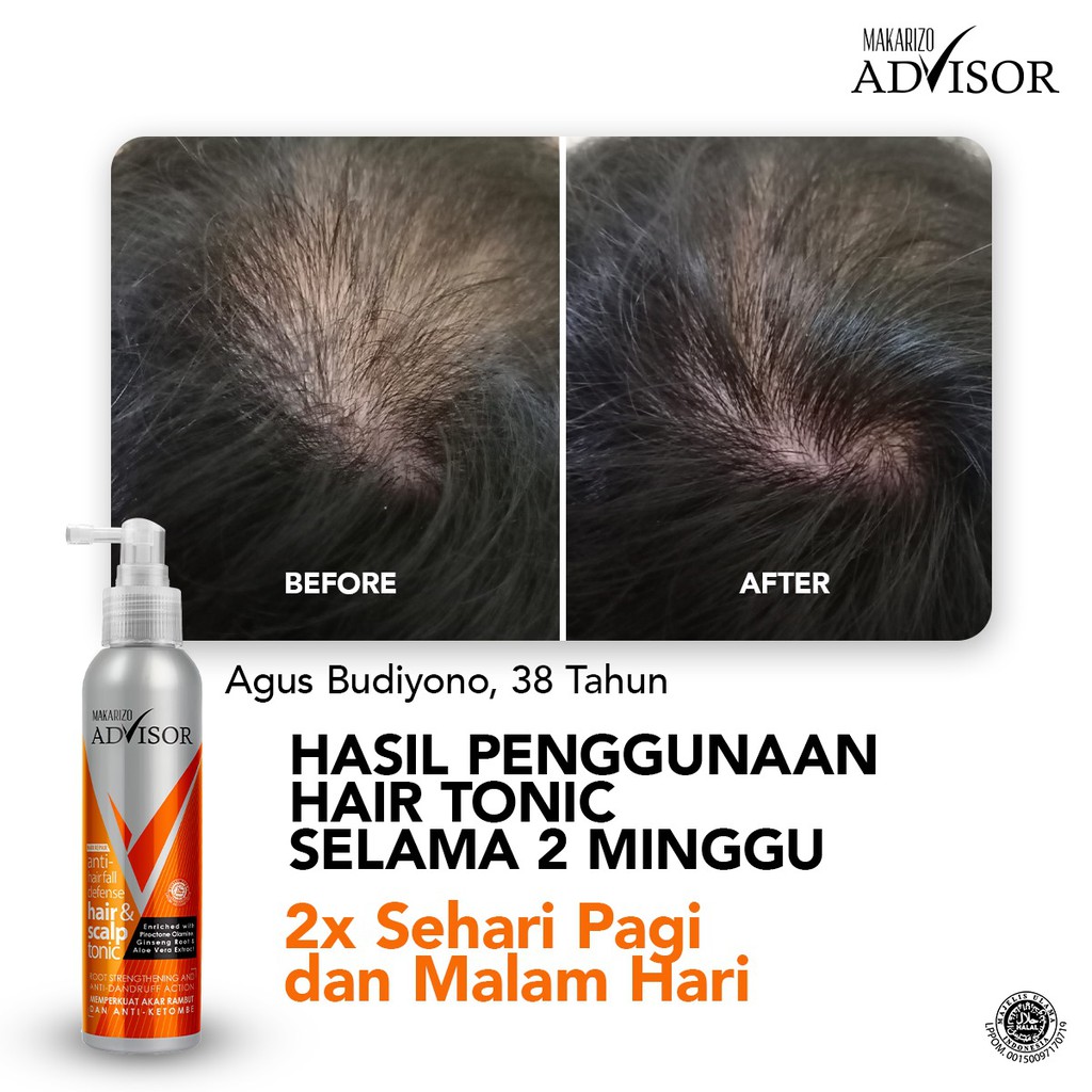 Macarizo Advisor Hair Scalp Tonic 145 Ml Loss And Dandruff Hair Care Anti Hair Fall Shopee Singapore
