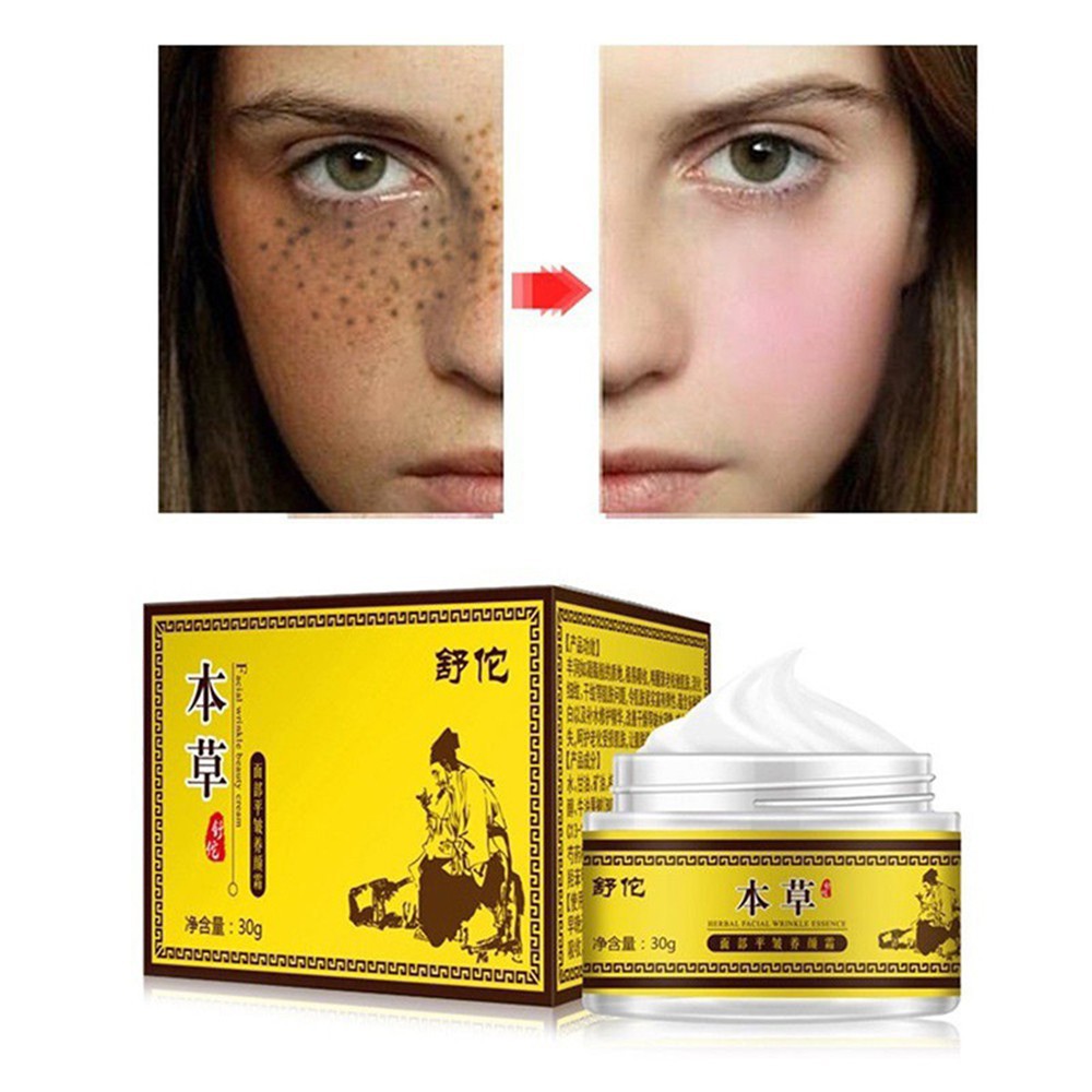 freckles treatment cream
