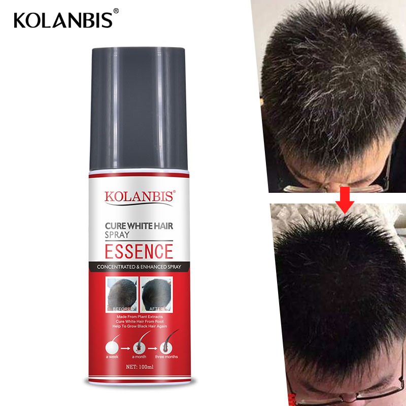 3 In SET Reduce White Hair Essence Spray Cure Gray Treatment Hair Scalp  Therapy Black Hair Care Hair Darkening Remedy | Shopee Singapore