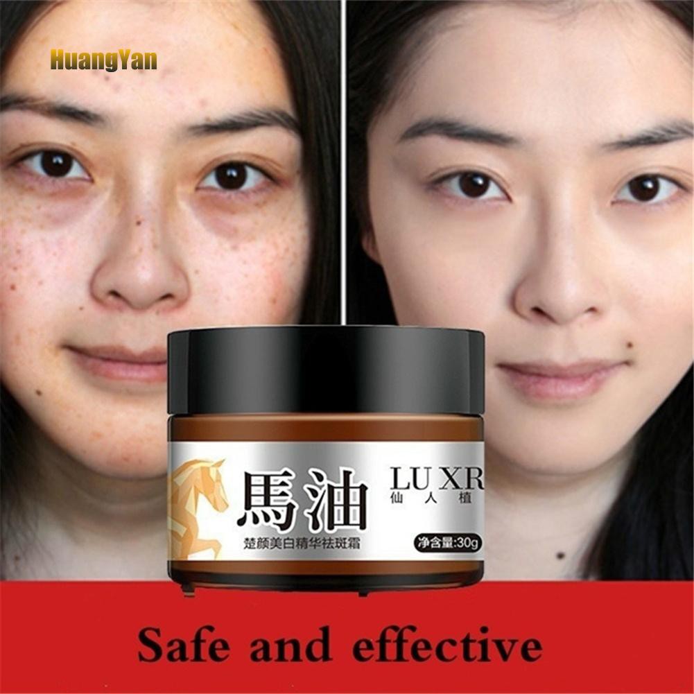 blemishes remove cream