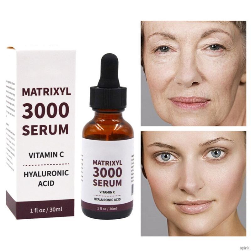 matrixyl for wrinkles