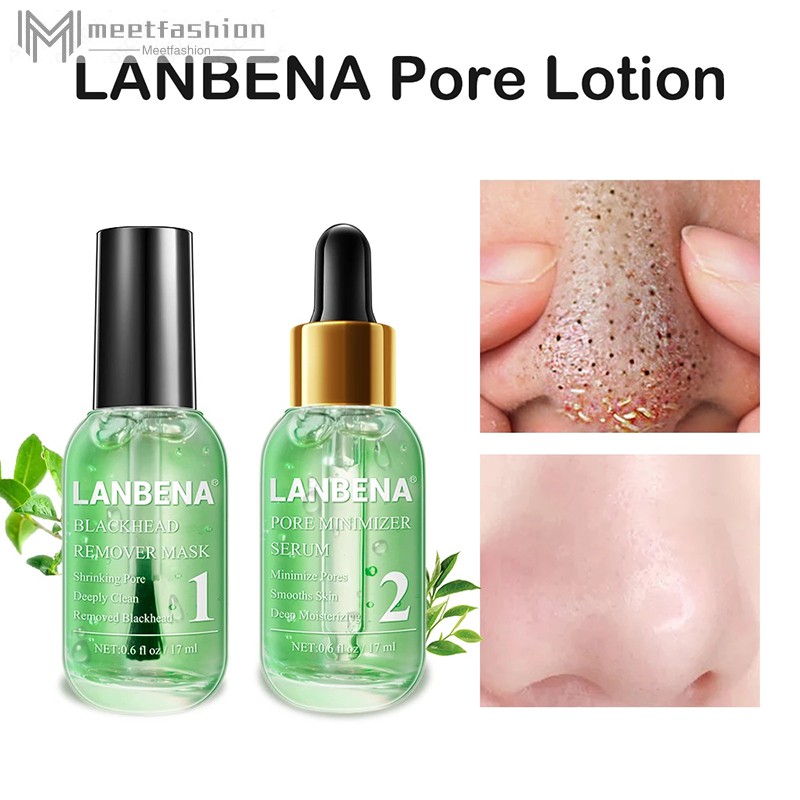 blackhead remover deep