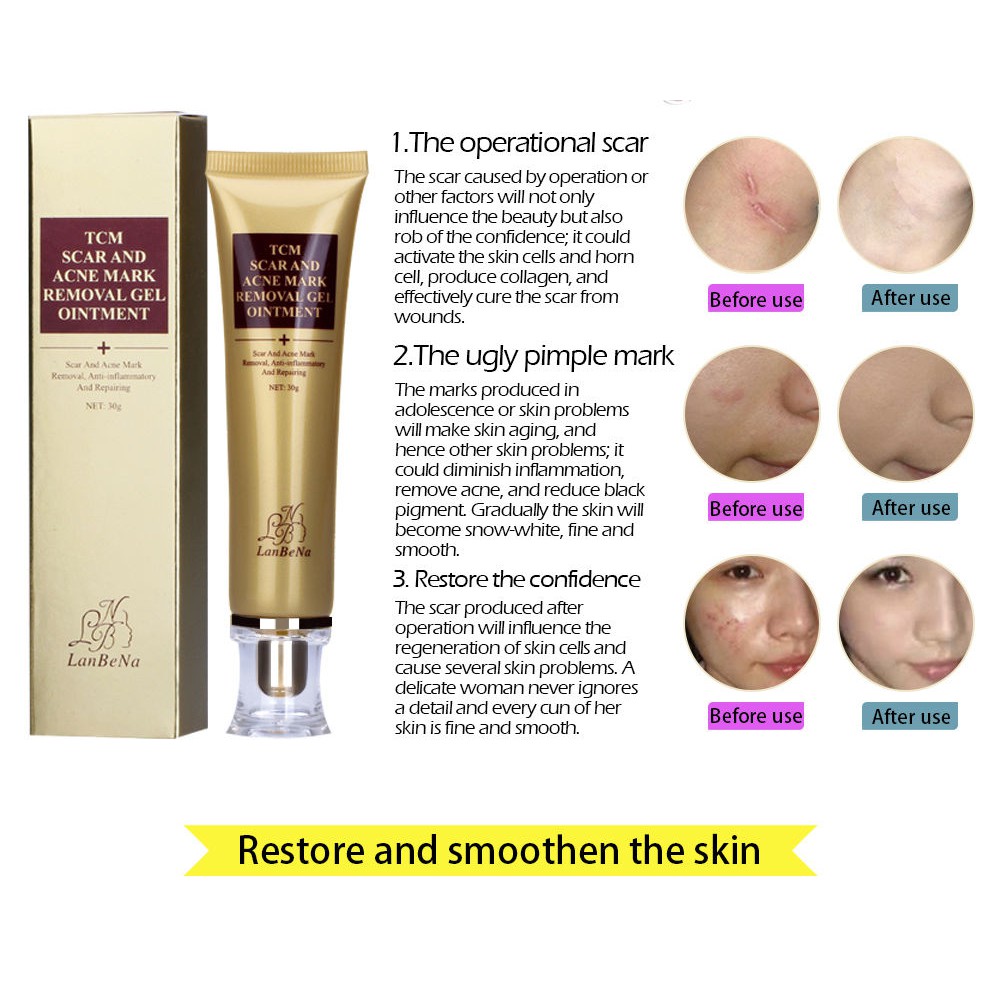 lanbena scar cream