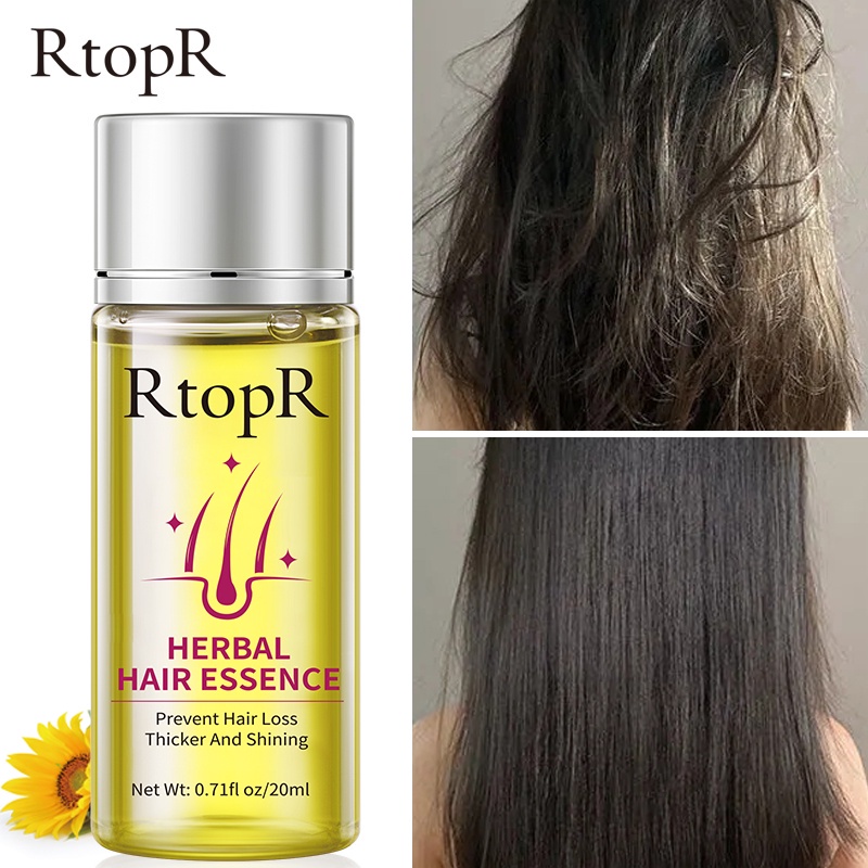 RtopR Herbal Hair Growth Anti Hair Loss Liquid Promote Thick Fast Hair  Growth Treatment Essential Oil Health Care 20ml | Shopee Singapore