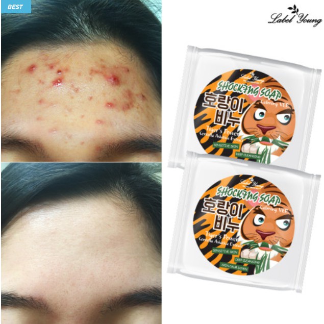 best scar removal soap