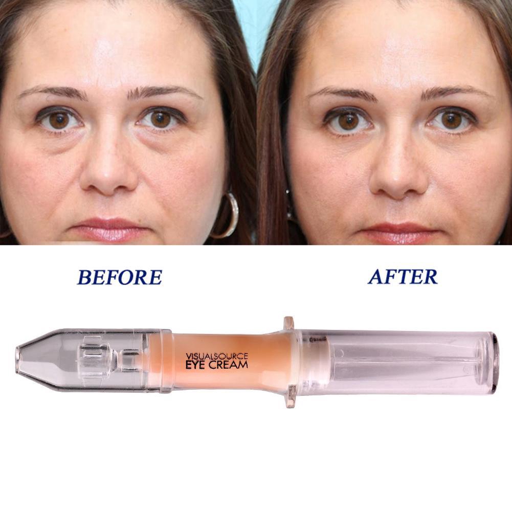 eye bag wrinkles