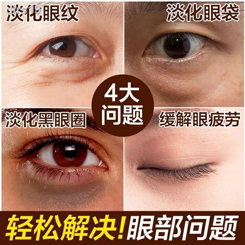 eye bag wrinkles
