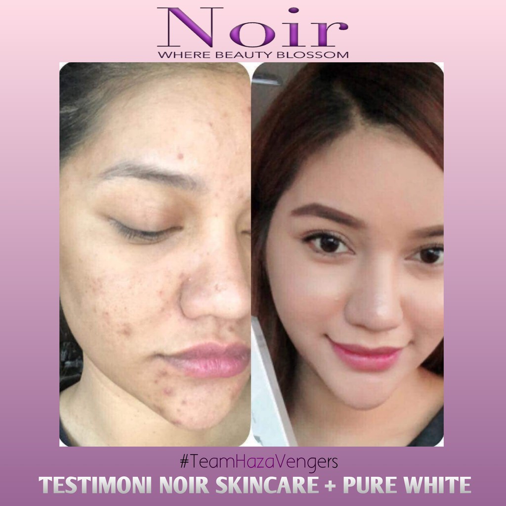 noir skincare testimoni