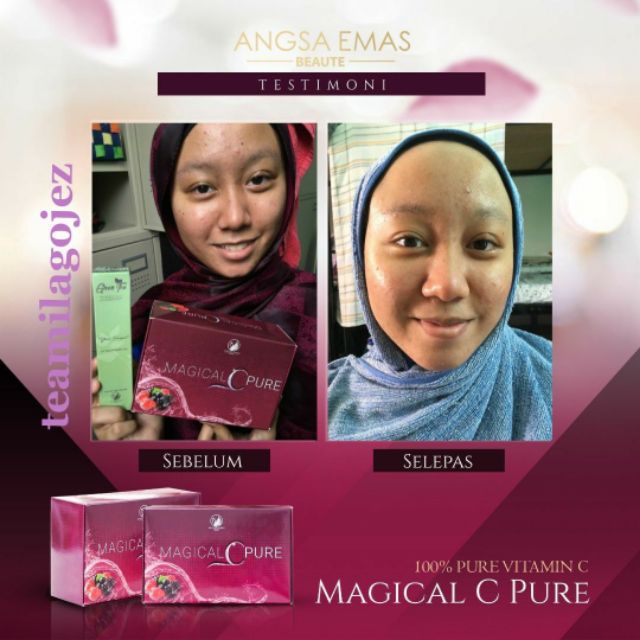 Miracle C Pure Supplement Vitamin C 12 Kotak Rm25 Box Shopee Singapore