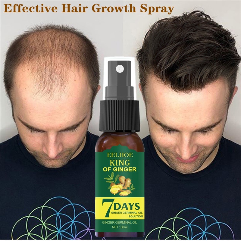 EELHOE Hair Growth Essence Germinal Serum Essence Oil Natural Hair Loss  Treatement Effective Fast Growth Scalp Treatment Men Women 30ml | Shopee  Singapore