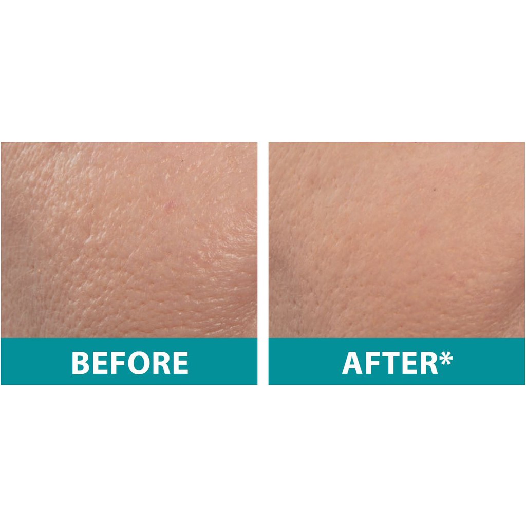 Remescar Instant Pore Reducer 20ml Shopee Singapore