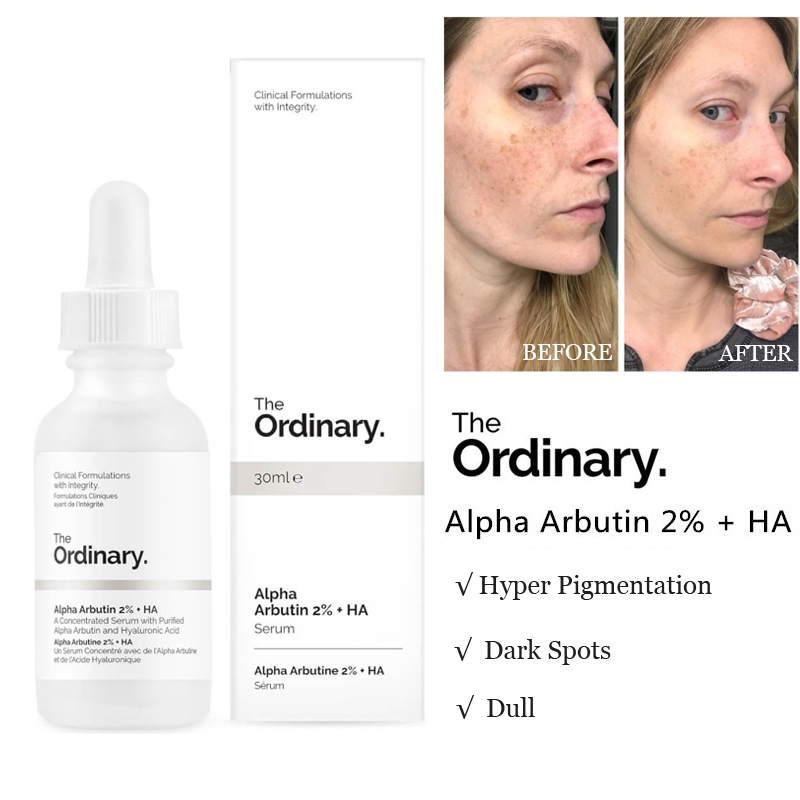 ordinary serum for face