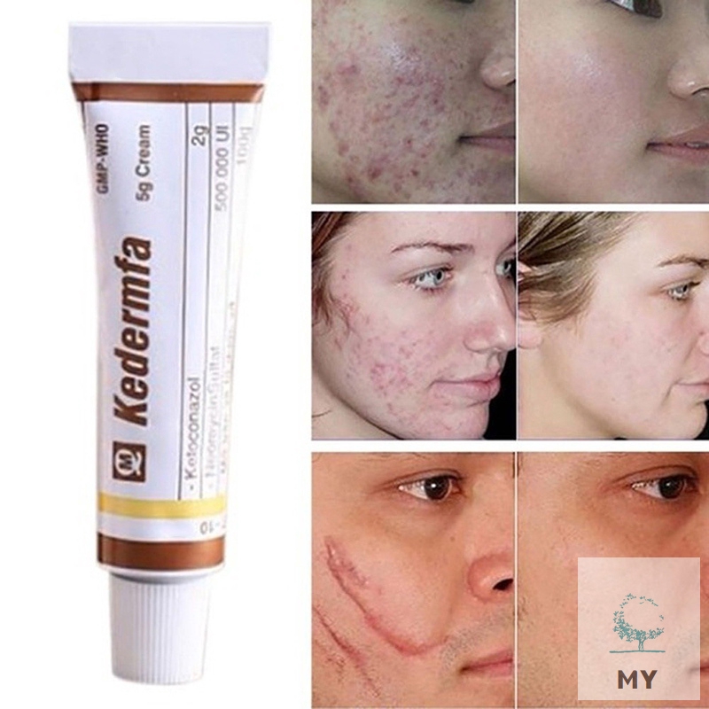 Youthful Scar Rejuvenating Burn Scar Removal Cream Vietnam Snake Oil