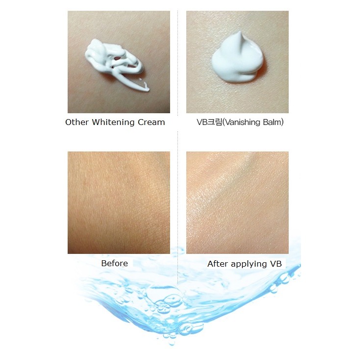 skin miracle vanishing cream
