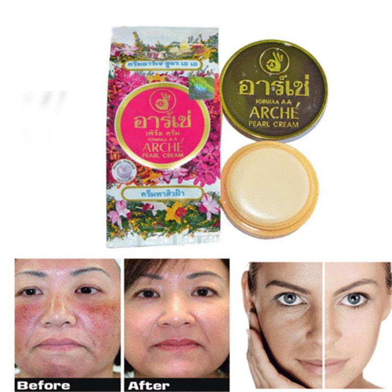 pearl acne cream