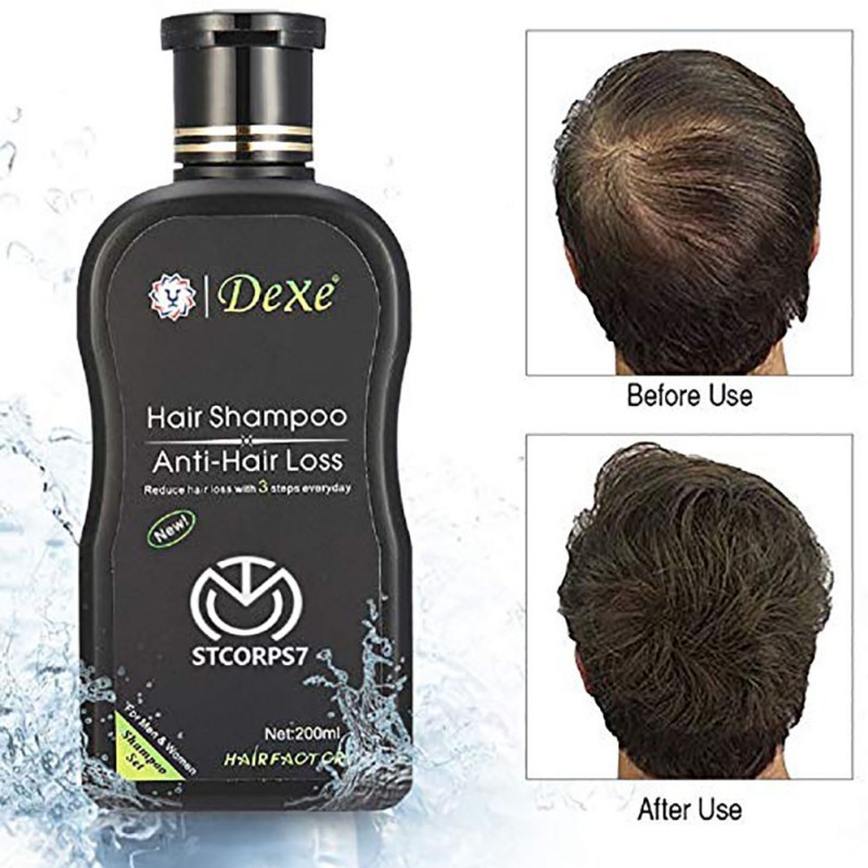 Anti Hair Loss Shampoo Improve Hair Quality Natural Herbal Extract