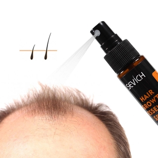 sevich Hair Growth Spray 30ml Antibacterial Treatment Hair Loss/Hair Growth Spray Extract Prevent Hair Loss  Hair Regrowth Essence Intensive Spray Women's Hair Regrowth Treatment for Hair Loss Ginger Juice Hair Growth Serum,Hair Loss Regrowth Treatments