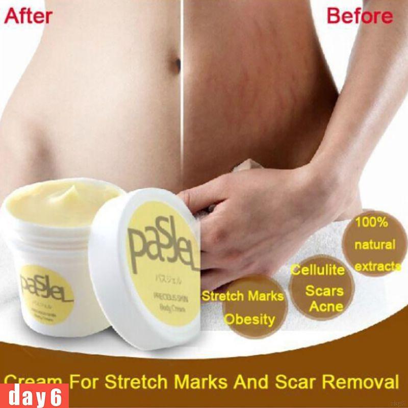 Scar Removal Stretch Marks Maternity Skin Body Care Cream