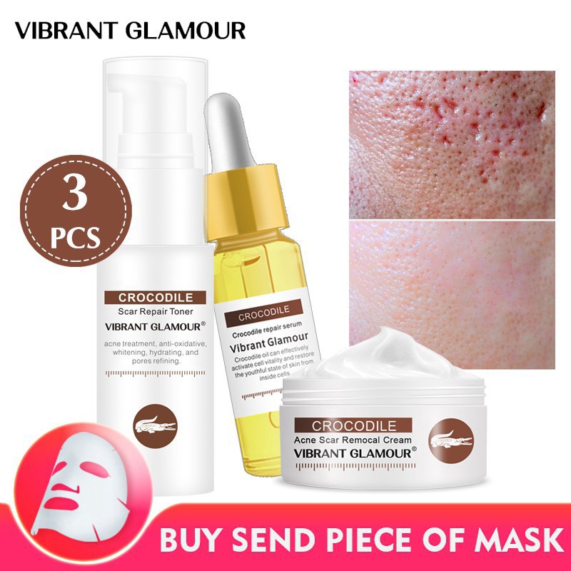 serum to lighten acne scars