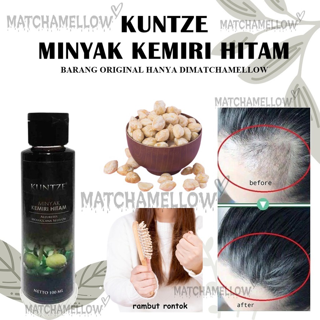 HITAM Omatcha ️ KUNTZE BPOM! Kuntze Black KEMIRI Oil BPOM - ORIGINAL Hair  Body Great; | Shopee Singapore