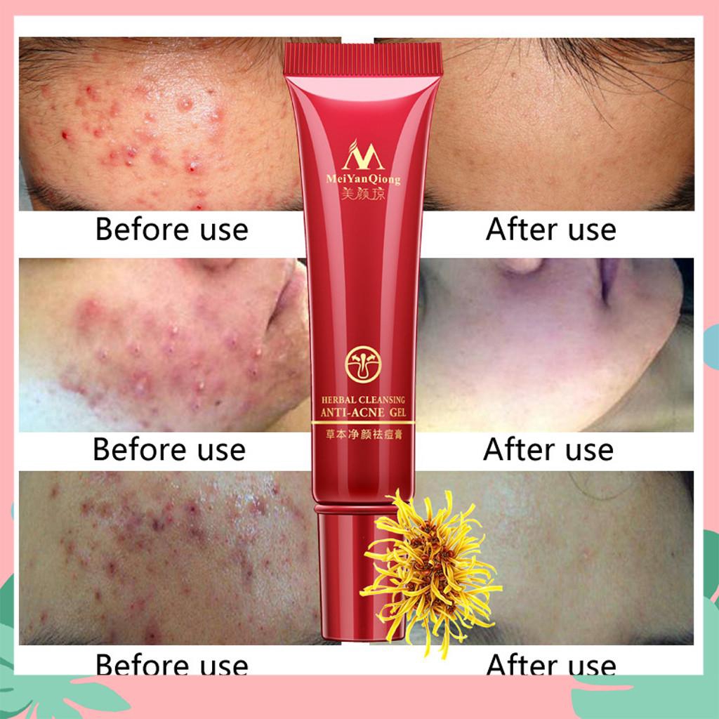 red spots removal cream