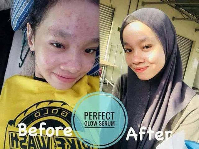 Nowa Beauty Perfect Glow Serum Lulus Kkm Shopee Singapore