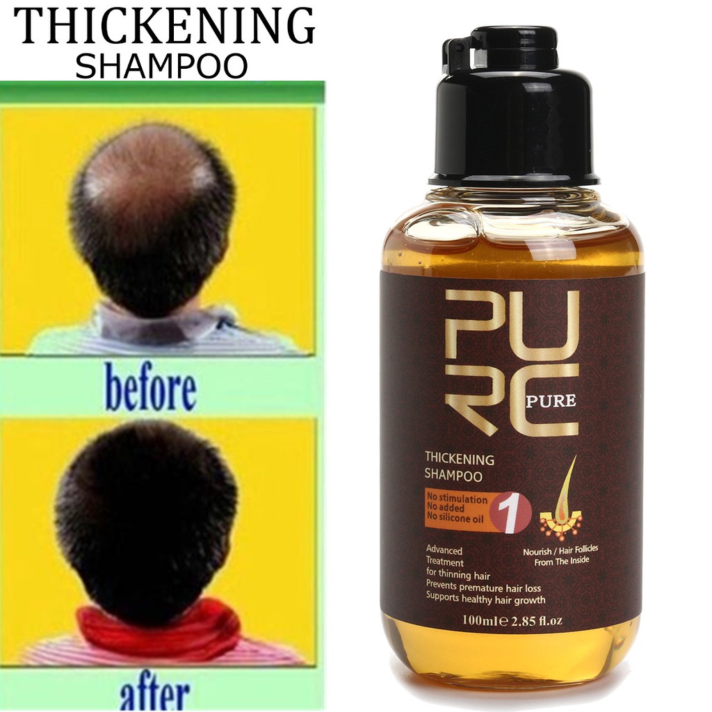 Ginger Cure Thickening Shampoo 100ml Anti Hair Loss Treatment Hair