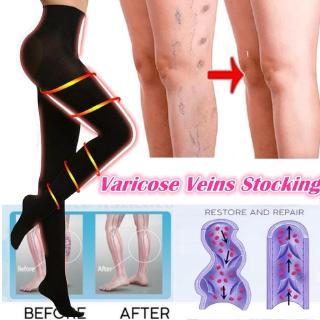 High Quality Breathable Compression Pressure Stocking Prevent Varicose Veins Stocking Shaped Beautiful Leg Pantyhose
